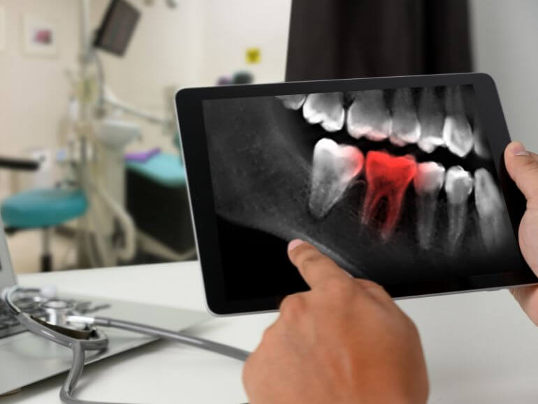 chirurgia orale mestre venezia